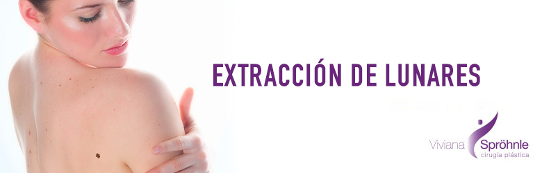 Extracción de Lunares
