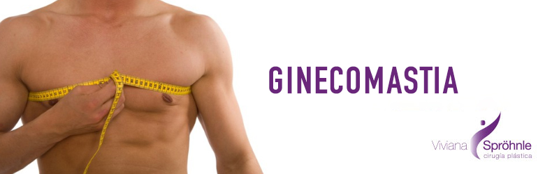 Ginecomastia