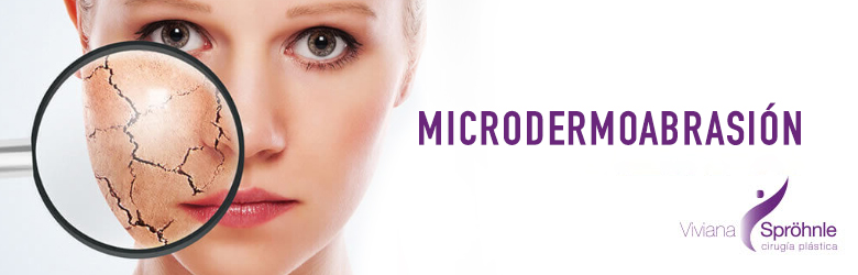 Microdermoabrasión