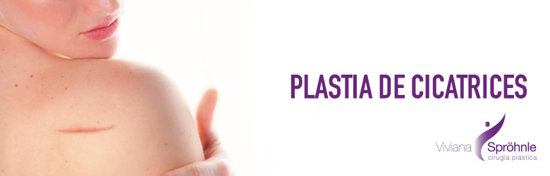 Plastia de Cicatrices