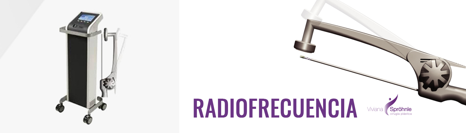 Radiofrecuencia