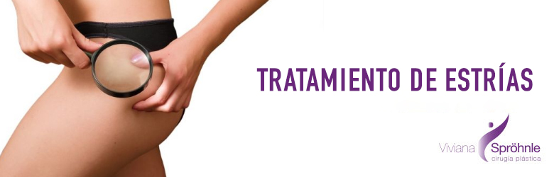 Tratamiento de estrías