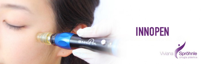 Innopen o microneedling